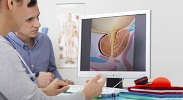 diagnosticiranje prostatitisa pri moških