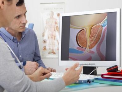 Urolog se posvetuje s pacientom o prostatitisu in metodah njegovega zdravljenja.